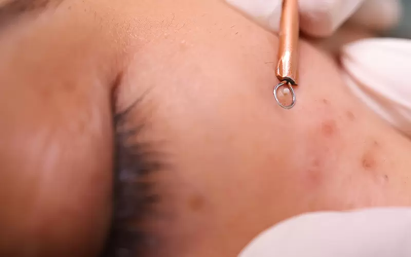 FAZE - Life Without Limits